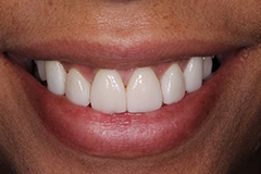 Smile Gallery - Eastgate Smiles