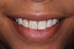 Smile Gallery - Eastgate Smiles