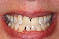 Smile Gallery - Eastgate Smiles