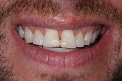 Smile Gallery - Eastgate Smiles