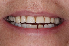 Smile Gallery - Eastgate Smiles