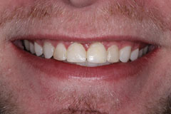 Smile Gallery - Eastgate Smiles