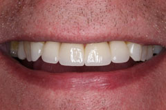 Smile Gallery - Eastgate Smiles